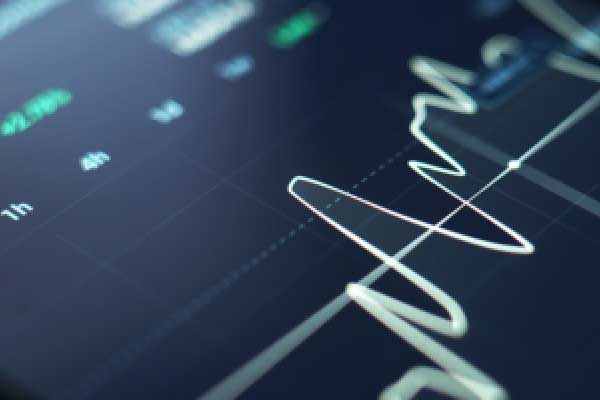 瑞银预计新兴市场涨势会持续更久 调整此前判断